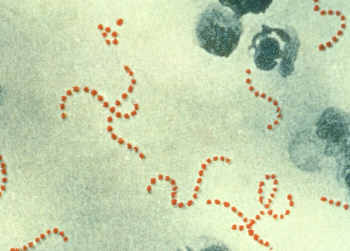 S. pyogenes bacteria